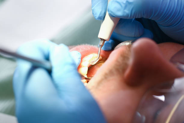 Best Pediatric Emergency Dentist in Saranac Lake, NY