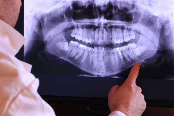 Best Emergency Cosmetic Dentistry in Saranac Lake, NY