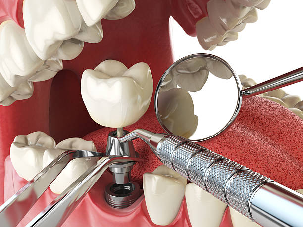 Best Mobile Emergency Dentist in Saranac Lake, NY